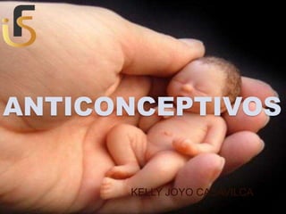 ANTICONCEPTIVOS
KELLY JOYO CASAVILCA
 