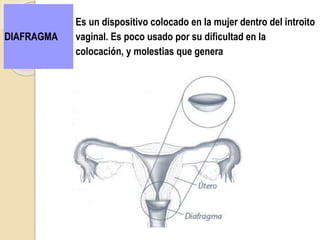 DIAFRAGMA
Es un dispositivo colocado en la mujer dentro del introito
vaginal. Es poco usado por su dificultad en la
colocación, y molestias que genera
 