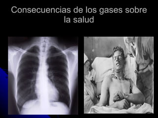 Consecuencias de los gases sobre la salud 