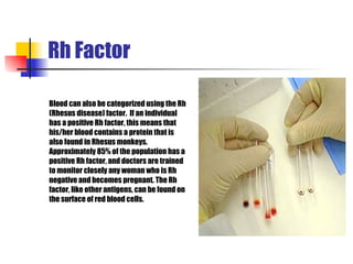 Rh Factor Blood can also be categorized using the Rh  (Rhesus disease) factor.  If an individual   has a positive Rh factor, this means that  his/her blood contains a protein that is   also found in Rhesus   monkeys.   Approximately 85% of the population has a  positive Rh factor, and doctors are trained  to monitor closely any woman who is Rh  negative and becomes pregnant. The Rh  factor, like other antigens, can be found on the surface of red blood cells.   