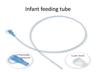 Infant feeding tube
 