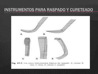 INSTRUMENTOS PARA RASPADO Y CURETEADO
 