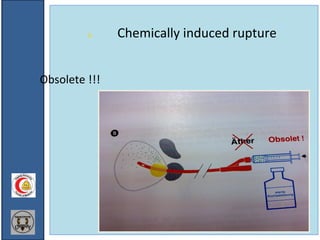 8. Chemically induced rupture
Obsolete !!!
 