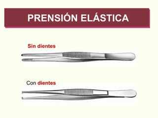 PRENSIÓN ELÁSTICA Sin dientes Con  dientes 