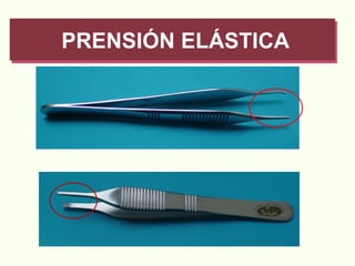 PRENSIÓN ELÁSTICA 