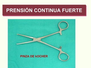 PRENSIÓN CONTINUA FUERTE PINZA DE kOCHER 