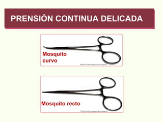 PRENSIÓN CONTINUA DELICADA Mosquito  curvo Mosquito recto 