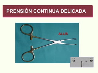PRENSIÓN CONTINUA DELICADA ALLIS 