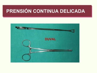 PRENSIÓN CONTINUA DELICADA DUVAL 