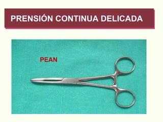 PRENSIÓN CONTINUA DELICADA PEAN 