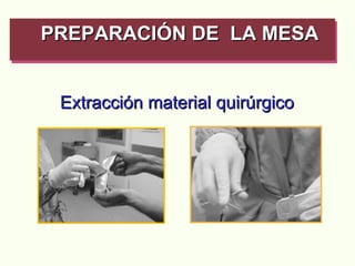 Extracción material quirúrgico PREPARACIÓN DE  LA MESA   