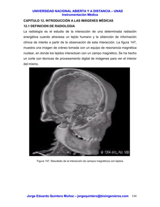 UUNNIIVVEERRSSIIDDAADD NNAACCIIOONNAALL AABBIIEERRTTAA YY AA DDIISSTTAANNCCIIAA –– UUNNAADD
IInnssttrruummeennttaacciióónn MMééddiiccaa
JJoorrggee EEdduuaarrddoo QQuuiinntteerroo MMuuññoozz –– jjoorrggeeqquuiinntteerroo@@bbiiooiinnggeenniieerrooss..ccoomm 144
CAPITULO 12. INTRODUCCIÓN A LAS IMÁGENES MÉDICAS
12.1 DEFINICION DE RADIOLOGIA
La radiología es el estudio de la interacción de una determinada radiación
energética cuando atraviesa un tejido humano y la obtención de información
clínica de interés a partir de la observación de esta interacción. La figura 147,
muestra una imagen de cráneo tomada con un equipo de resonancia magnética
nuclear, en donde los tejidos interactúan con un campo magnético. Se ha hecho
un corte con técnicas de procesamiento digital de imágenes para ver el interior
del mismo.
Figura 147. Resultado de la interacción de campos magnéticos con tejidos
 