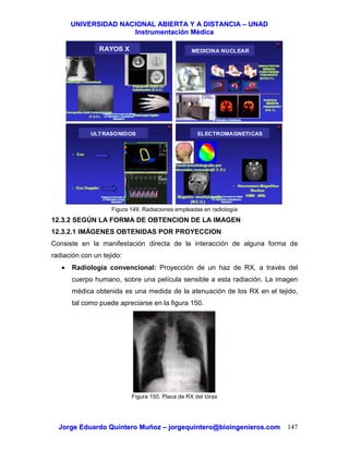 UUNNIIVVEERRSSIIDDAADD NNAACCIIOONNAALL AABBIIEERRTTAA YY AA DDIISSTTAANNCCIIAA –– UUNNAADD
IInnssttrruummeennttaacciióónn MMééddiiccaa
JJoorrggee EEdduuaarrddoo QQuuiinntteerroo MMuuññoozz –– jjoorrggeeqquuiinntteerroo@@bbiiooiinnggeenniieerrooss..ccoomm 147
Figura 149. Radiaciones empleadas en radiología
12.3.2 SEGÚN LA FORMA DE OBTENCION DE LA IMAGEN
12.3.2.1 IMÁGENES OBTENIDAS POR PROYECCION
Consiste en la manifestación directa de la interacción de alguna forma de
radiación con un tejido:
• Radiología convencional: Proyección de un haz de RX, a través del
cuerpo humano, sobre una película sensible a esta radiación. La imagen
médica obtenida es una medida de la atenuación de los RX en el tejido,
tal como puede apreciarse en la figura 150.
Figura 150. Placa de RX del tórax
RAYOS X MEDICINA NUCLEAR
ULTRASONIDOS ELECTROMAGNETICAS
 