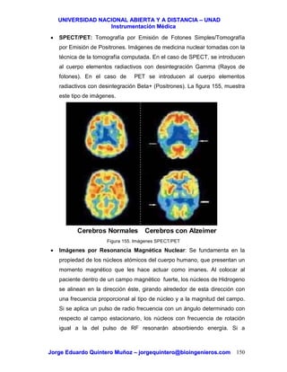 UUNNIIVVEERRSSIIDDAADD NNAACCIIOONNAALL AABBIIEERRTTAA YY AA DDIISSTTAANNCCIIAA –– UUNNAADD
IInnssttrruummeennttaacciióónn MMééddiiccaa
JJoorrggee EEdduuaarrddoo QQuuiinntteerroo MMuuññoozz –– jjoorrggeeqquuiinntteerroo@@bbiiooiinnggeenniieerrooss..ccoomm 150
• SPECT/PET: Tomografía por Emisión de Fotones Simples/Tomografía
por Emisión de Positrones. Imágenes de medicina nuclear tomadas con la
técnica de la tomografía computada. En el caso de SPECT, se introducen
al cuerpo elementos radiactivos con desintegración Gamma (Rayos de
fotones). En el caso de PET se introducen al cuerpo elementos
radiactivos con desintegración Beta+ (Positrones). La figura 155, muestra
este tipo de imágenes.
Figura 155. Imágenes SPECT/PET
• Imágenes por Resonancia Magnética Nuclear: Se fundamenta en la
propiedad de los núcleos atómicos del cuerpo humano, que presentan un
momento magnético que les hace actuar como imanes. Al colocar al
paciente dentro de un campo magnético fuerte, los núcleos de Hidrogeno
se alinean en la dirección éste, girando alrededor de esta dirección con
una frecuencia proporcional al tipo de núcleo y a la magnitud del campo.
Si se aplica un pulso de radio frecuencia con un ángulo determinado con
respecto al campo estacionario, los núcleos con frecuencia de rotación
igual a la del pulso de RF resonarán absorbiendo energía. Si a
Cerebros Normales Cerebros con Alzeimer
 