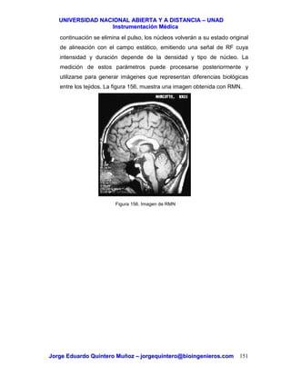 UUNNIIVVEERRSSIIDDAADD NNAACCIIOONNAALL AABBIIEERRTTAA YY AA DDIISSTTAANNCCIIAA –– UUNNAADD
IInnssttrruummeennttaacciióónn MMééddiiccaa
JJoorrggee EEdduuaarrddoo QQuuiinntteerroo MMuuññoozz –– jjoorrggeeqquuiinntteerroo@@bbiiooiinnggeenniieerrooss..ccoomm 151
continuación se elimina el pulso, los núcleos volverán a su estado original
de alineación con el campo estático, emitiendo una señal de RF cuya
intensidad y duración depende de la densidad y tipo de núcleo. La
medición de estos parámetros puede procesarse posteriormente y
utilizarse para generar imágenes que representan diferencias biológicas
entre los tejidos. La figura 156, muestra una imagen obtenida con RMN.
Figura 156. Imagen de RMN
 