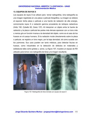 UUNNIIVVEERRSSIIDDAADD NNAACCIIOONNAALL AABBIIEERRTTAA YY AA DDIISSTTAANNCCIIAA –– UUNNAADD
IInnssttrruummeennttaacciióónn MMééddiiccaa
JJoorrggee EEdduuaarrddoo QQuuiinntteerroo MMuuññoozz –– jjoorrggeeqquuiinntteerroo@@bbiiooiinnggeenniieerrooss..ccoomm 152
13. EQUIPOS DE RAYOS X
Los equipos de rayos X se utilizan para tomar radiografías. Una radiografía es
una imagen registrada en una placa o película fotográfica. La imagen se obtiene
al exponer dicha placa o película a una fuente de radiación de alta energía,
comúnmente rayos X o radiación gamma procedente de isótopos radiactivos
(Iridio 192, Cobalto 60, Cesio 137). Al interponer un objeto entre la fuente de
radiación y la placa o película las partes más densas aparecen con un tono más
o menos gris en función inversa a la densidad del objeto, como es el caso de los
huesos en el cuerpo humano. Si la radiación incide directamente sobre la placa
o película, se registra un tono negro, por la baja densidad, tal como sucede con
los pulmones. Sus usos pueden ser tanto médicos, para detectar fisuras en
huesos, como industriales en la detección de defectos en materiales y
soldaduras tales como grietas y poros. La figura 157, muestra un equipo de RX
utilizado para tomar una radiografía de tórax y la imagen resultante.
Figura 157. Radiografía de tórax tomada con equipo de rayos X
 