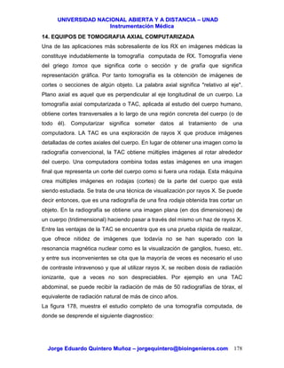 UUNNIIVVEERRSSIIDDAADD NNAACCIIOONNAALL AABBIIEERRTTAA YY AA DDIISSTTAANNCCIIAA –– UUNNAADD
IInnssttrruummeennttaacciióónn MMééddiiccaa
JJoorrggee EEdduuaarrddoo QQuuiinntteerroo MMuuññoozz –– jjoorrggeeqquuiinntteerroo@@bbiiooiinnggeenniieerrooss..ccoomm 178
14. EQUIPOS DE TOMOGRAFIA AXIAL COMPUTARIZADA
Una de las aplicaciones más sobresaliente de los RX en imágenes médicas la
constituye indudablemente la tomografía computada de RX. Tomografía viene
del griego tomos que significa corte o sección y de grafía que significa
representación gráfica. Por tanto tomografía es la obtención de imágenes de
cortes o secciones de algún objeto. La palabra axial significa "relativo al eje".
Plano axial es aquel que es perpendicular al eje longitudinal de un cuerpo. La
tomografía axial computarizada o TAC, aplicada al estudio del cuerpo humano,
obtiene cortes transversales a lo largo de una región concreta del cuerpo (o de
todo él). Computarizar significa someter datos al tratamiento de una
computadora. LA TAC es una exploración de rayos X que produce imágenes
detalladas de cortes axiales del cuerpo. En lugar de obtener una imagen como la
radiografía convencional, la TAC obtiene múltiples imágenes al rotar alrededor
del cuerpo. Una computadora combina todas estas imágenes en una imagen
final que representa un corte del cuerpo como si fuera una rodaja. Esta máquina
crea múltiples imágenes en rodajas (cortes) de la parte del cuerpo que está
siendo estudiada. Se trata de una técnica de visualización por rayos X. Se puede
decir entonces, que es una radiografía de una fina rodaja obtenida tras cortar un
objeto. En la radiografía se obtiene una imagen plana (en dos dimensiones) de
un cuerpo (tridimensional) haciendo pasar a través del mismo un haz de rayos X.
Entre las ventajas de la TAC se encuentra que es una prueba rápida de realizar,
que ofrece nitidez de imágenes que todavía no se han superado con la
resonancia magnética nuclear como es la visualización de ganglios, hueso, etc.
y entre sus inconvenientes se cita que la mayoría de veces es necesario el uso
de contraste intravenoso y que al utilizar rayos X, se reciben dosis de radiación
ionizante, que a veces no son despreciables. Por ejemplo en una TAC
abdominal, se puede recibir la radiación de más de 50 radiografías de tórax, el
equivalente de radiación natural de más de cinco años.
La figura 178, muestra el estudio completo de una tomografía computada, de
donde se desprende el siguiente diagnostico:
 