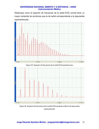 UUNNIIVVEERRSSIIDDAADD NNAACCIIOONNAALL AABBIIEERRTTAA YY AA DDIISSTTAANNCCIIAA –– UUNNAADD
IInnssttrruummeennttaacciióónn MMééddiiccaa
JJoorrggee EEdduuaarrddoo QQuuiinntteerroo MMuuññoozz –– jjoorrggeeqquuiinntteerroo@@bbiiooiinnggeenniieerrooss..ccoomm 32
Obsérvese como el espectro de frecuencia de la señal ECG normal tiene un
mayor contenido de armónicos que la de señal correspondiente a la taquicardia
supraventricular.
Figura 35. Espectro de frecuencia de la señal ECG paciente sano
Figura 36. Espectro de frecuencia de la señal ECG paciente enfermo de taquicardia
supraventicular
 