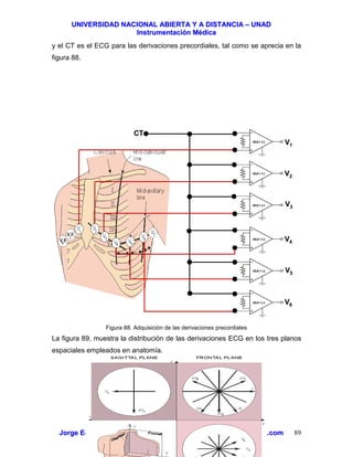 UUNNIIVVEERRSSIIDDAADD NNAACCIIOONNAALL AABBIIEERRTTAA YY AA DDIISSTTAANNCCIIAA –– UUNNAADD
IInnssttrruummeennttaacciióónn MMééddiiccaa
JJoorrggee EEdduuaarrddoo QQuuiinntteerroo MMuuññoozz –– jjoorrggeeqquuiinntteerroo@@bbiiooiinnggeenniieerrooss..ccoomm 89
y el CT es el ECG para las derivaciones precordiales, tal como se aprecia en la
figura 88.
Figura 88. Adquisición de las derivaciones precordiales
La figura 89, muestra la distribución de las derivaciones ECG en los tres planos
espaciales empleados en anatomía.
VV11
VV22
VV33
VV44
VV55
VV66
CTCT
 