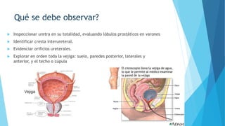 Qué es?
 El cabestrillo suburetral transobturatriz, es el tratamiento de elección para la
incontinencia urinaria.
 Se tr...