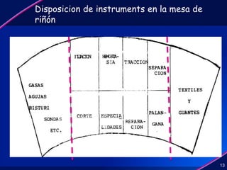 Disposicion de instruments en la mesa de
riñón
13
 