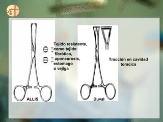 Tejido resistente,
        como tejido
         fibrótico,
         aponeurosis,                Tracción en cavidad
        estomago                           toracica
        o vejiga




ALLIS                        Duval
 
