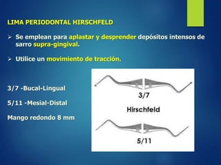LIMA PERIODONTAL HIRSCHFELD 
 Se emplean para aplastar y desprender depósitos intensos de 
sarro supra-gingival. 
 Utilice un movimiento de tracción. 
3/7 -Bucal-Lingual 
5/11 -Mesial-Distal 
Mango redondo 8 mm 
 