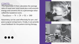 Masometer Ii instrumental assesment of velopharyngeal closure.pptx