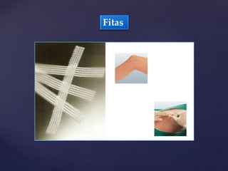 Fitas
 