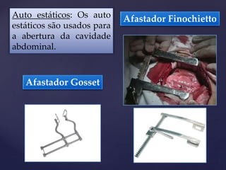 Auto estáticos: Os auto
estáticos são usados para
a abertura da cavidade
abdominal.
Afastador Finochietto
Afastador Gosset
 