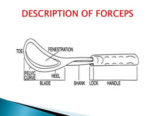  5-Simpson forceps- Deliver the fetus with a
moulded head as is common in nulliparous
women.
 6-Tucker-Mclane is often u...
