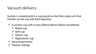 Vacuum delivery
Suction is created within a cup placed on the fetal scalp such that
traction on the cup aids fetal expulsion
13
 A suction cup with 4 sizes (30mm,40mm,50mm and 60mm)
 Metal cup
 Soft cup
 Silastic cup
 Rigid plastic cup
 Vacuum generator
 Traction tubings
 