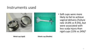 Instruments used
Metal cup (rigid) Silastic cup (flexible)
• Soft cups were more
likely to fail to achieve
vaginal delivery (Failure
rate 14.8% vs 9.5%), but
were associated with
less scalp injury than
rigid cups (13% vs 24%)5
15
 