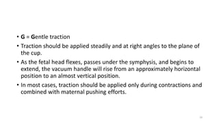 • G = Gentle traction
• Traction should be applied steadily and at right angles to the plane of
the cup.
• As the fetal head flexes, passes under the symphysis, and begins to
extend, the vacuum handle will rise from an approximately horizontal
position to an almost vertical position.
• In most cases, traction should be applied only during contractions and
combined with maternal pushing efforts.
19
 