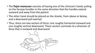 • The Pajot maneuver consists of having one of the clinician’s hands pulling
on the forceps handles in the same direction that the handles extend
outward and away from the patient
• The other hand should be placed on the shanks, from above or below,
and a downward pull exerted
• Thus, there are two vectors of force: one roughly horizontal outward and
one roughly vertical downward. These vectors summate to a direction of
force that is outward and downward
39
 