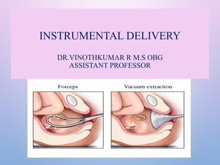 Icon Normal Delivery Using Instruments instrumentaldelivery obstetrics and gynaecology | PPTX