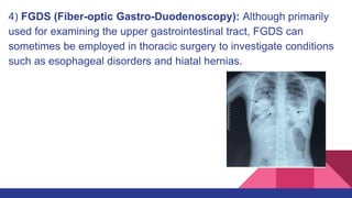 Instrumental_Diagnostic_Studies_Of_Thoracic_Surgery_Operations_on.pptx
