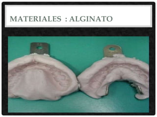 MATERIALES : ALGINATO
 