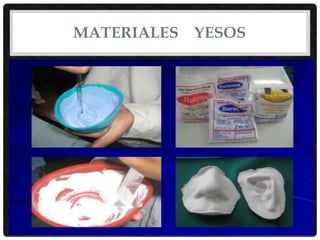 MATERIALES YESOS
 