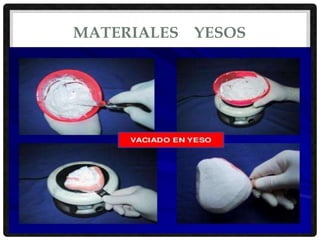 MATERIALES YESOS
 