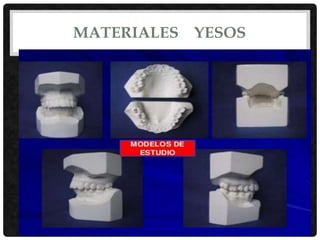 MATERIALES YESOS
 