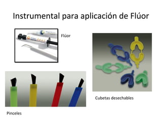 Instrumental para aplicación de Flúor
Flúor
Pinceles
Cubetas desechables
 