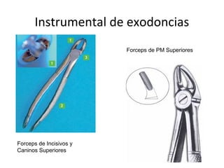 Instrumental de exodoncias
Forceps de Incisivos y
Caninos Superiores
Forceps de PM Superiores
 