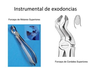 Instrumental de exodoncias
Forceps de Molares Superiores
Forceps de Cordales Superiores
 