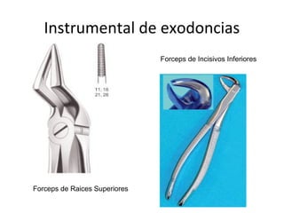 Instrumental de exodoncias
Forceps de Raices Superiores
Forceps de Incisivos Inferiores
 