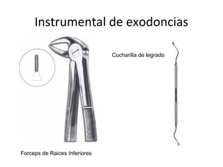 Instrumental de exodoncias
Forceps de Raices Inferiores
Cucharilla de legrado
 
