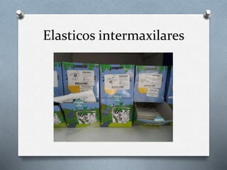 Elasticos intermaxilares
 