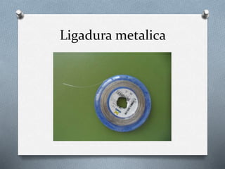 Ligadura metalica
 