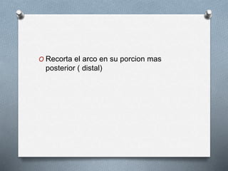 O Recorta el arco en su porcion mas
posterior ( distal)
 