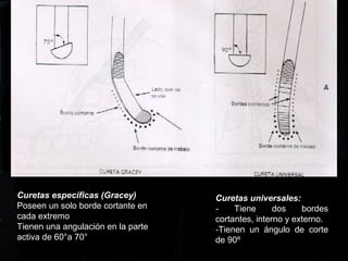 Curetas universales:
- Tiene dos bordes
cortantes, interno y externo.
-Tienen un ángulo de corte
de 90º
Curetas especificas (Gracey)
Poseen un solo borde cortante en
cada extremo
Tienen una angulación en la parte
activa de 60°a 70°
 